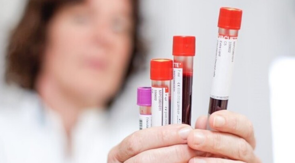 Lonkanker-uitzaaiingen-ctdna