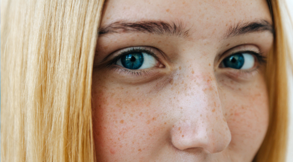 Sarcomen-betere-toekomst