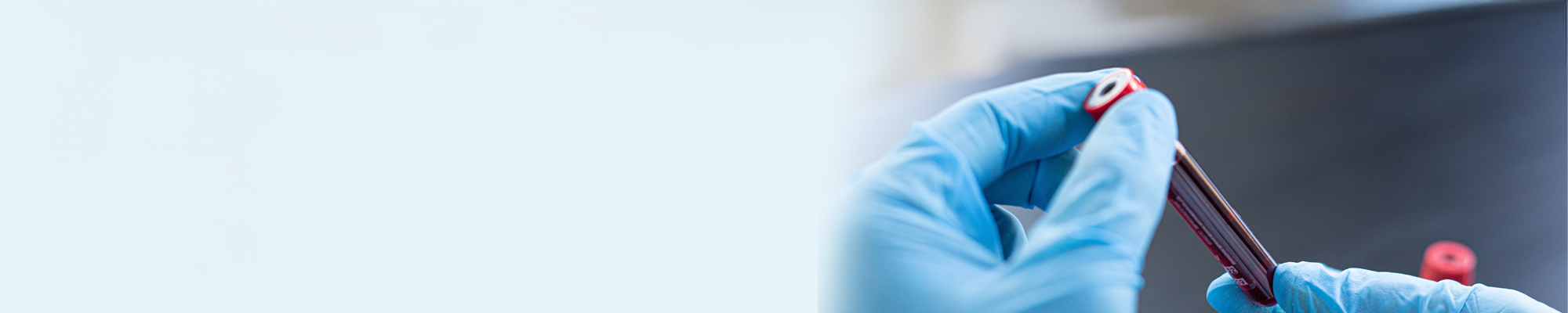 Leukemie-bloedsample-header