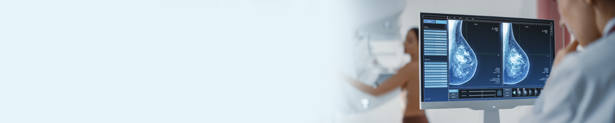 Mammografie AI header