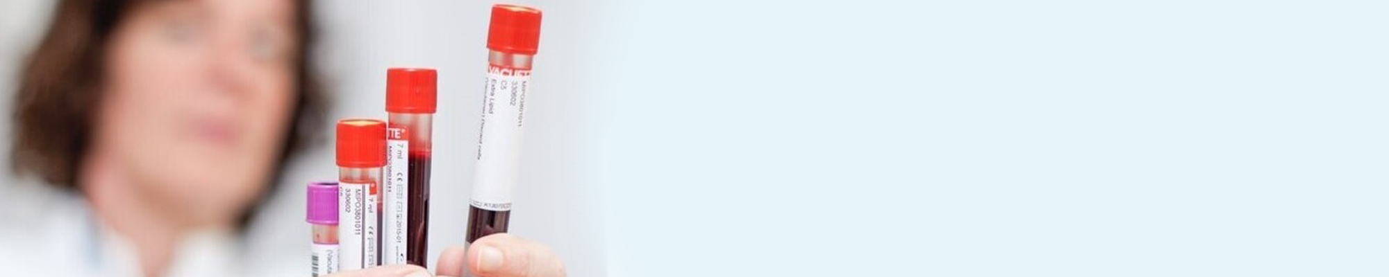 Longkanker-uitzaaiingen-ctdna-header