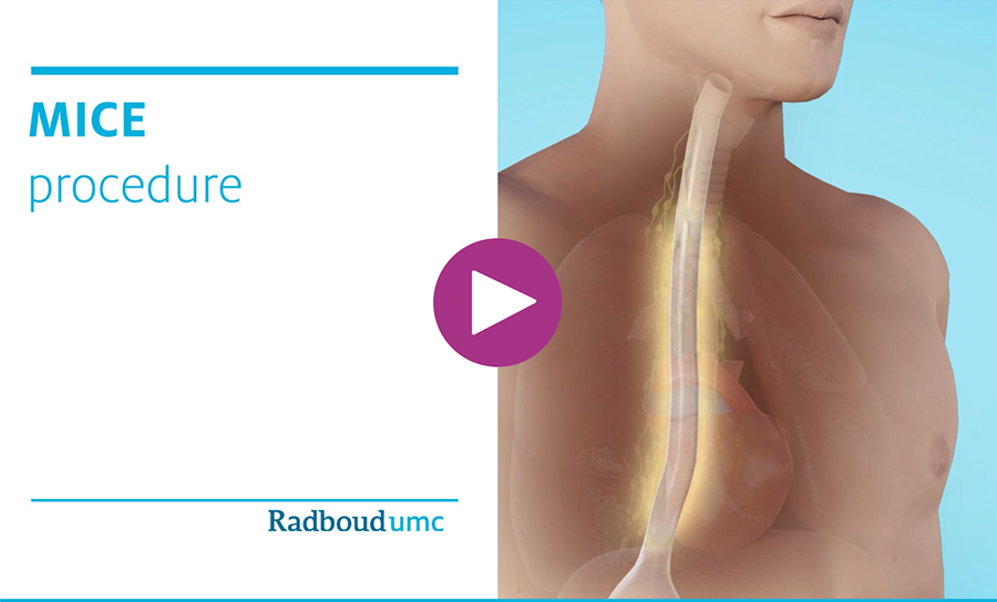 MICE procedure