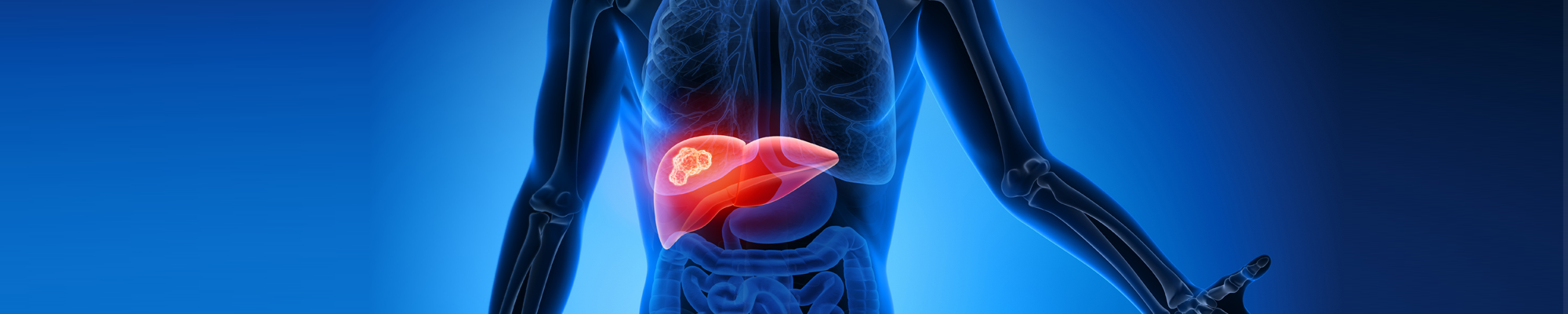 Leverkanker-onderzoek