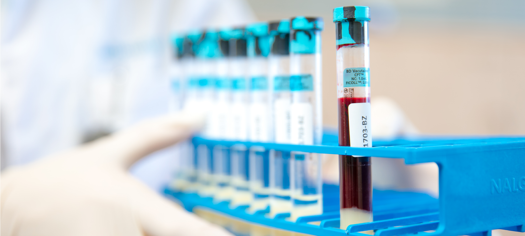 DNA-fouten-bestudeerd-nog-voordat-ze-tot-kanker-leiden