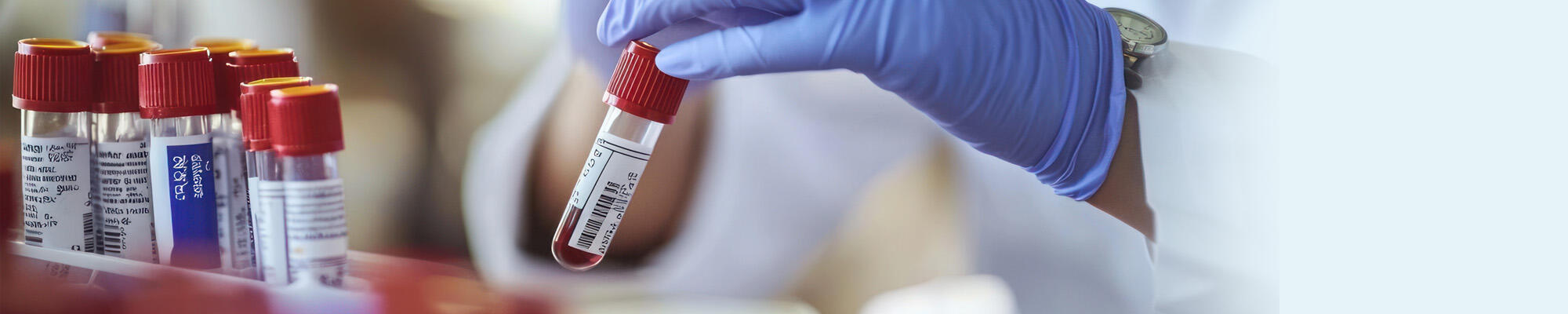 acute-leukemie-stamceltransplantatie
